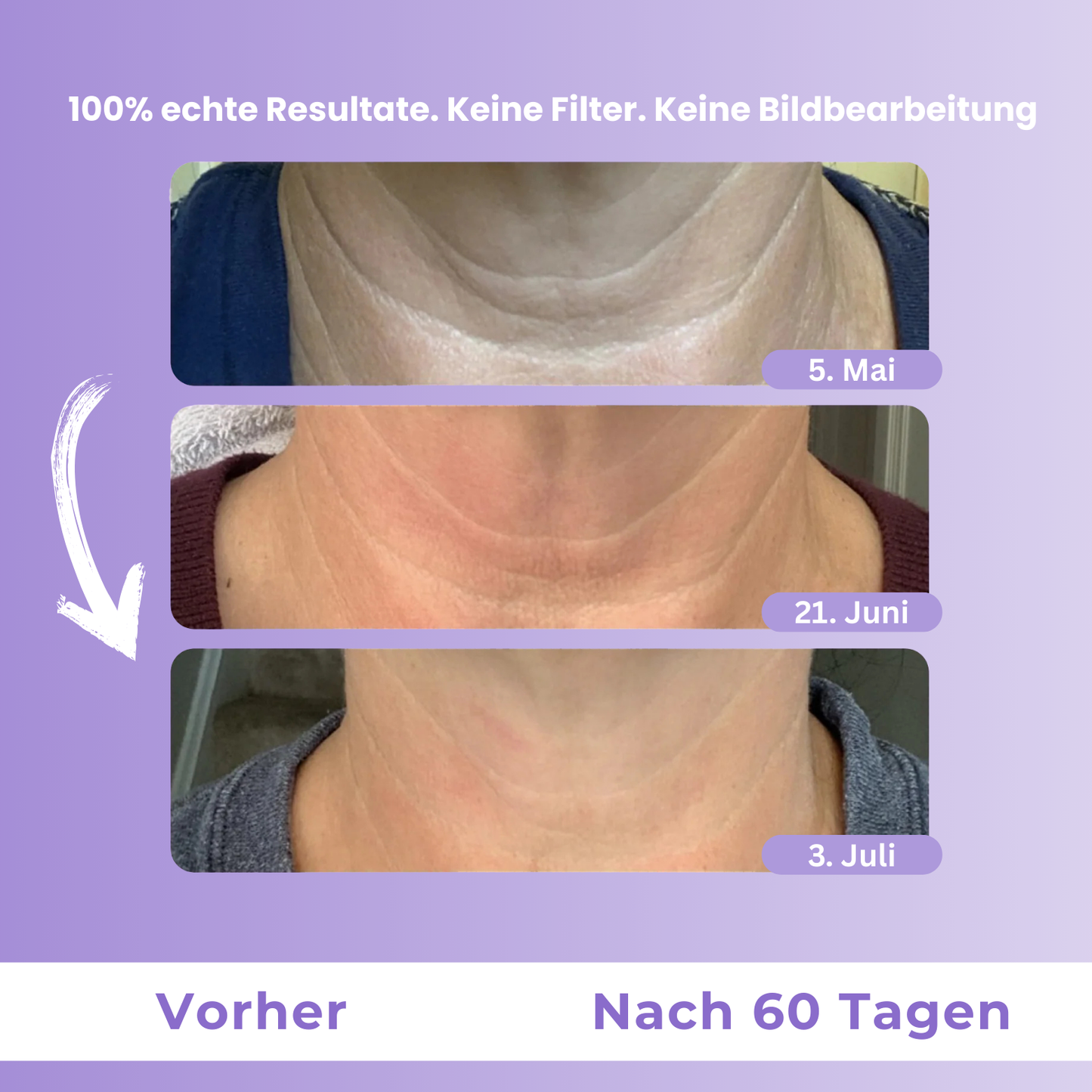 Motemas Straffende & liftende Halscreme (50ml)