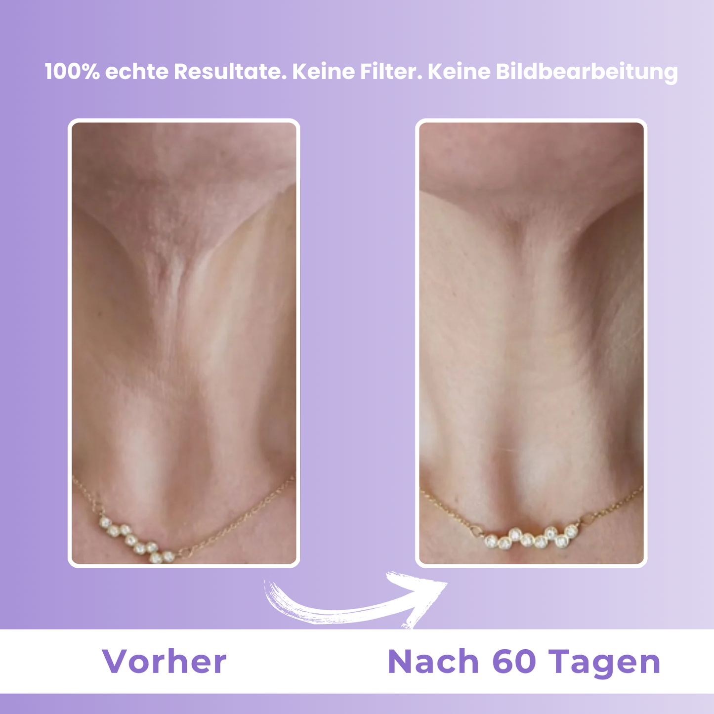 Motemas Straffende & liftende Halscreme (50ml)