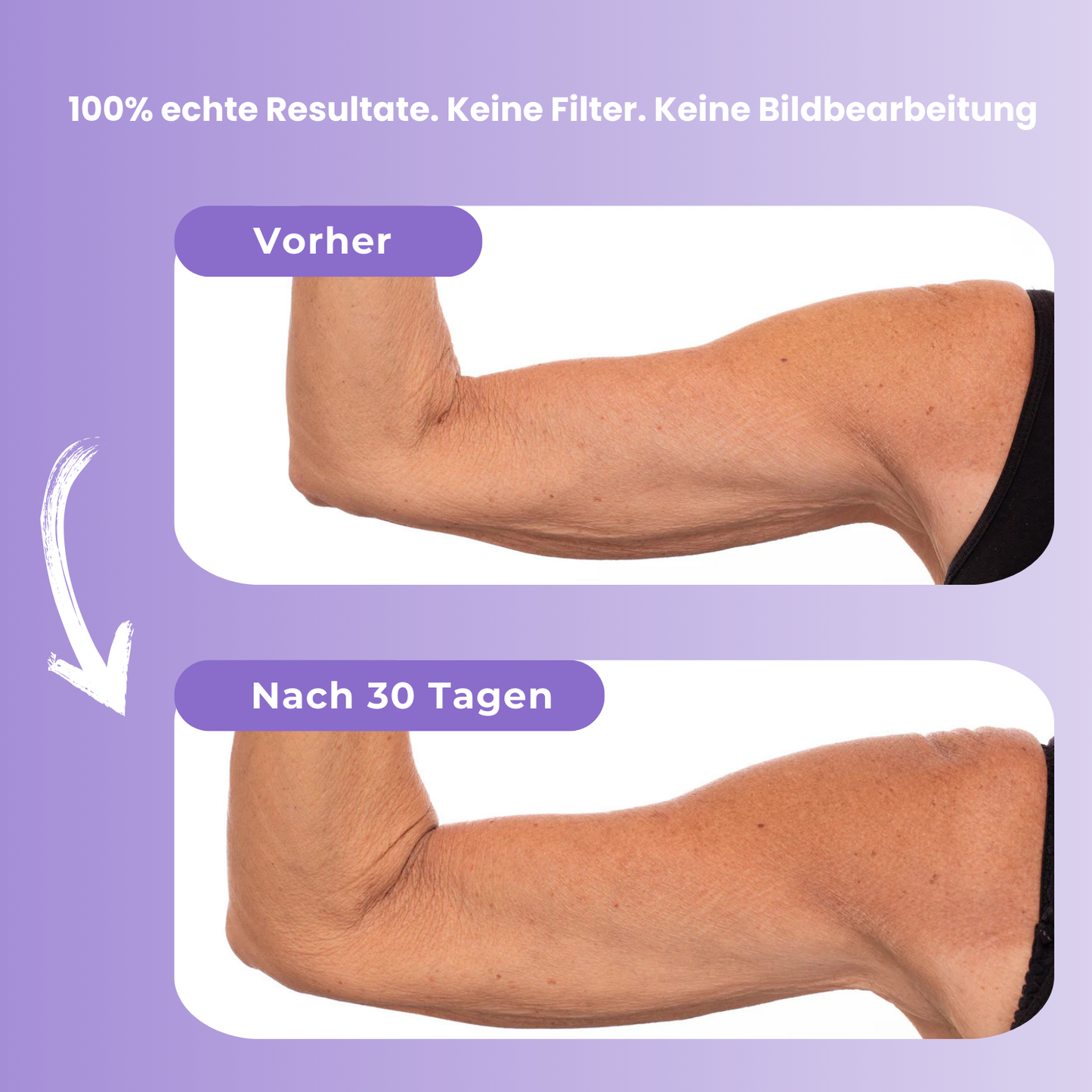 Motemas Armcreme (100ml)